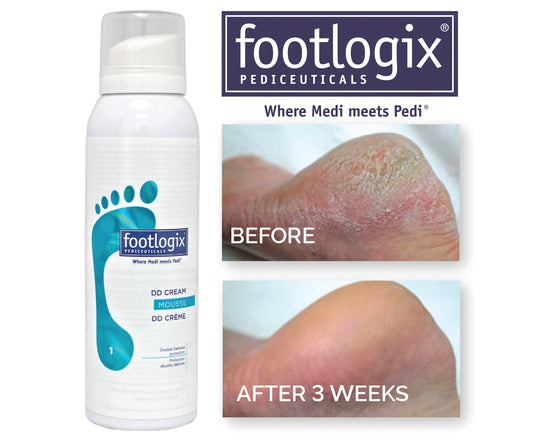 Footlogix DD Cream Mousse 1