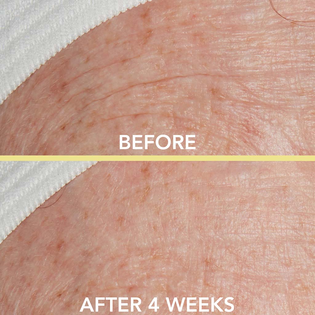 TRIPLE PEPTIDE DROPS