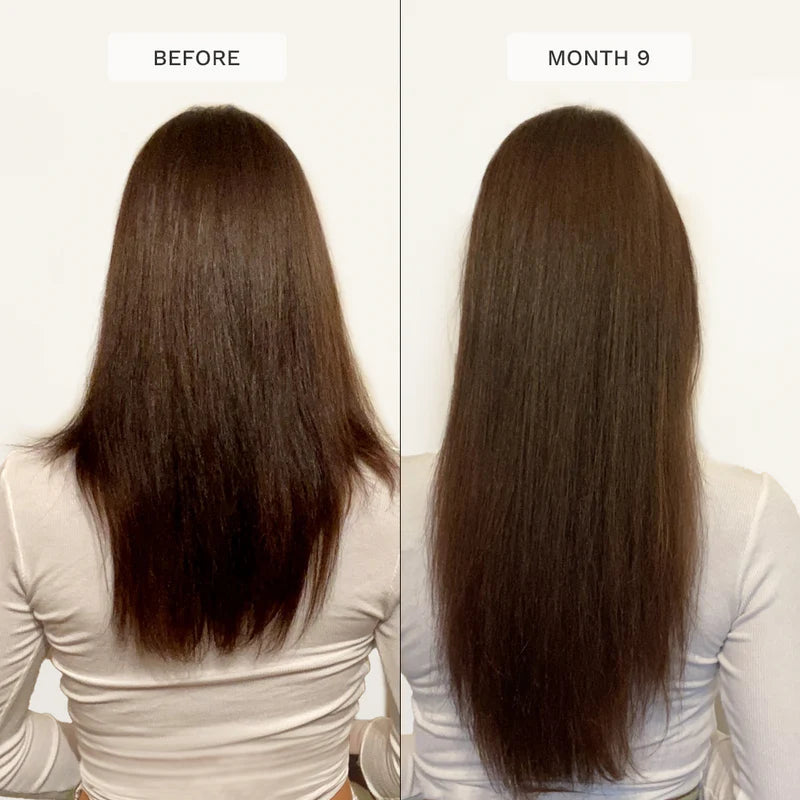 HAIRBURST FOR LONGER STRONGER HAIR SET-(SHAMPOO+CONDITIONER)