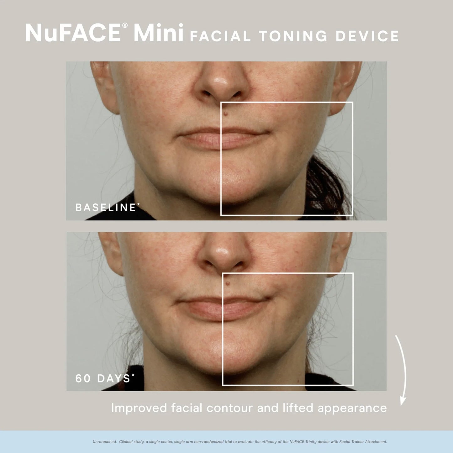 MINI FACIAL TONING DEVICE