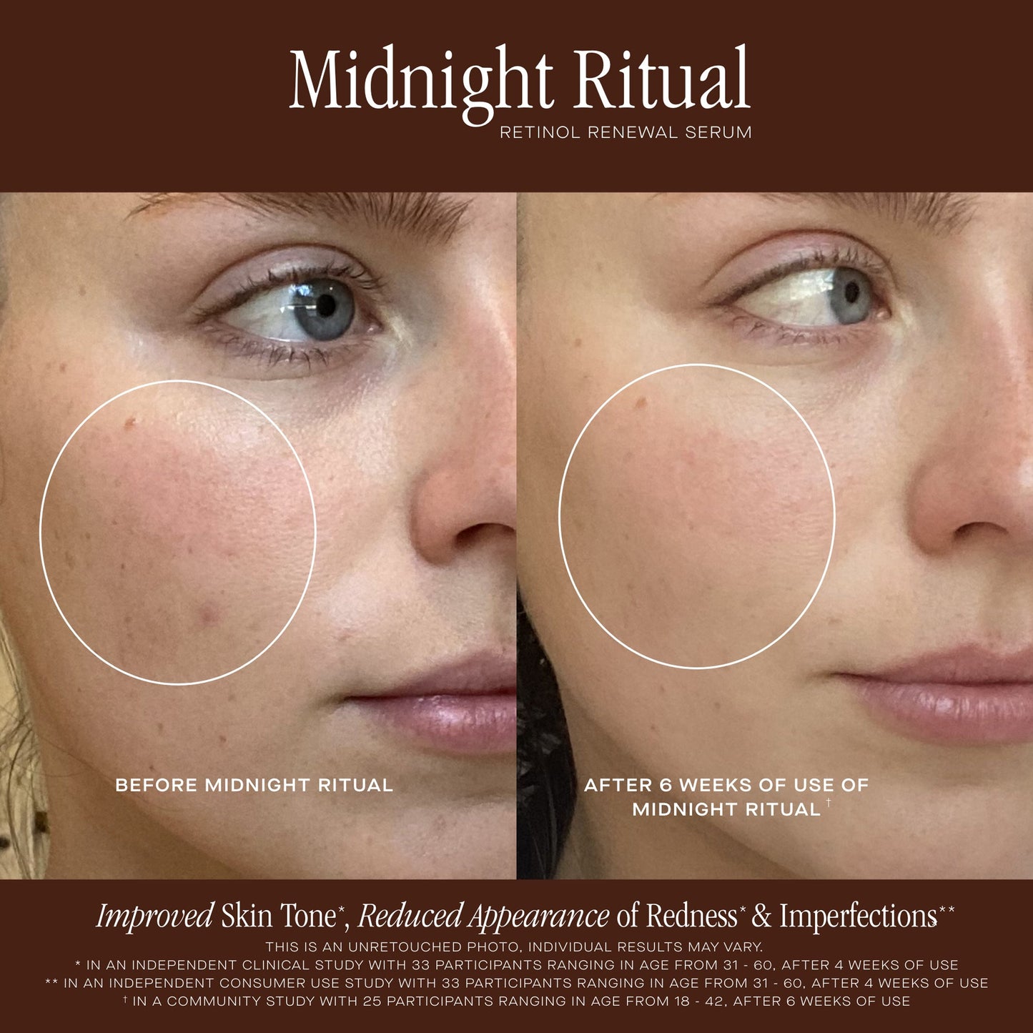 MIDNIGHT RITUAL RETINOL RENEWAL SERUM