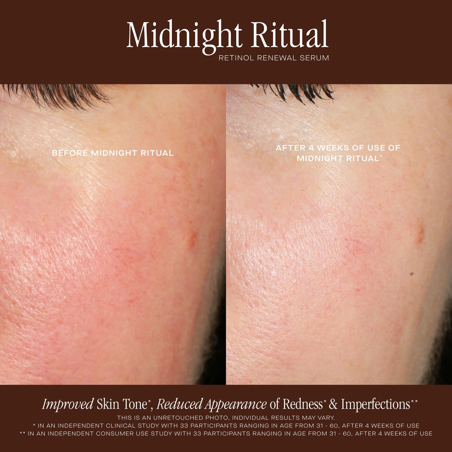 MIDNIGHT RITUAL RETINOL RENEWAL SERUM