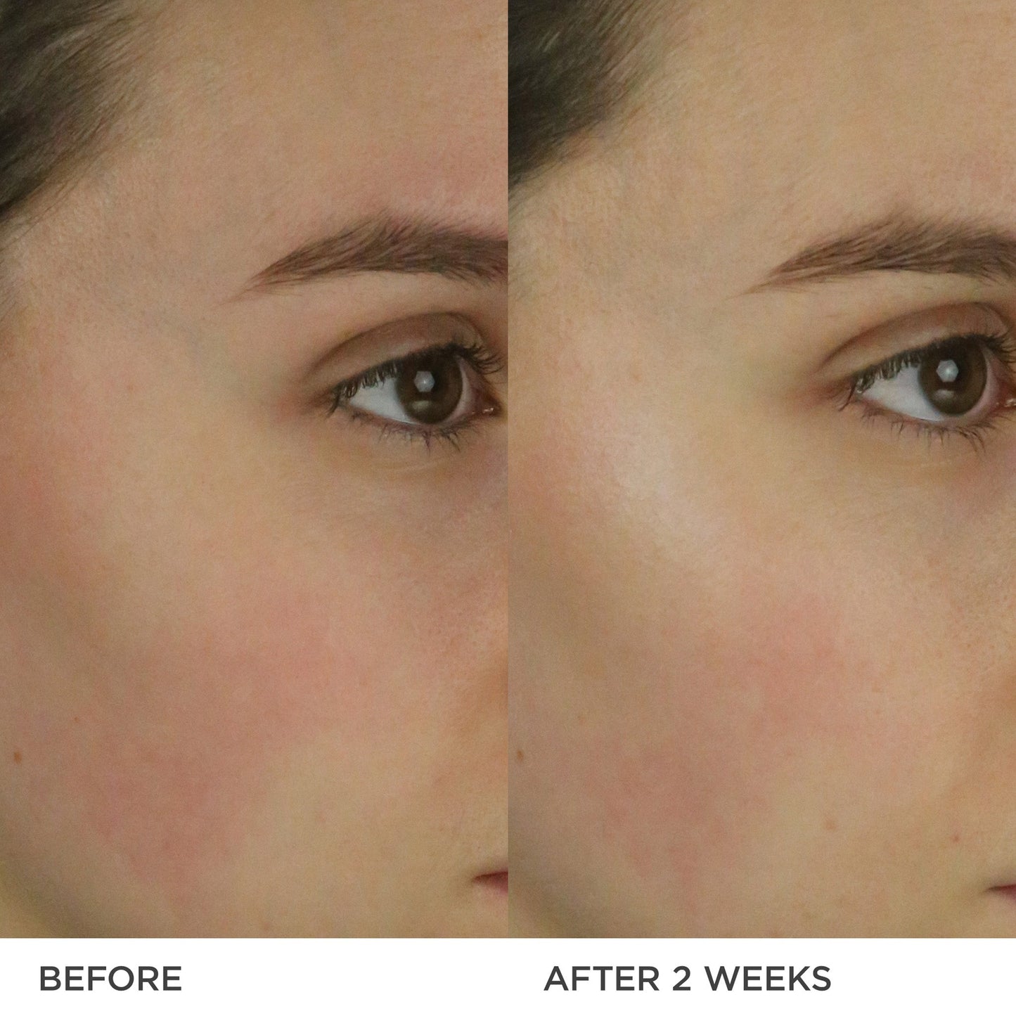 THE DEWY MILK MOISTURIZER