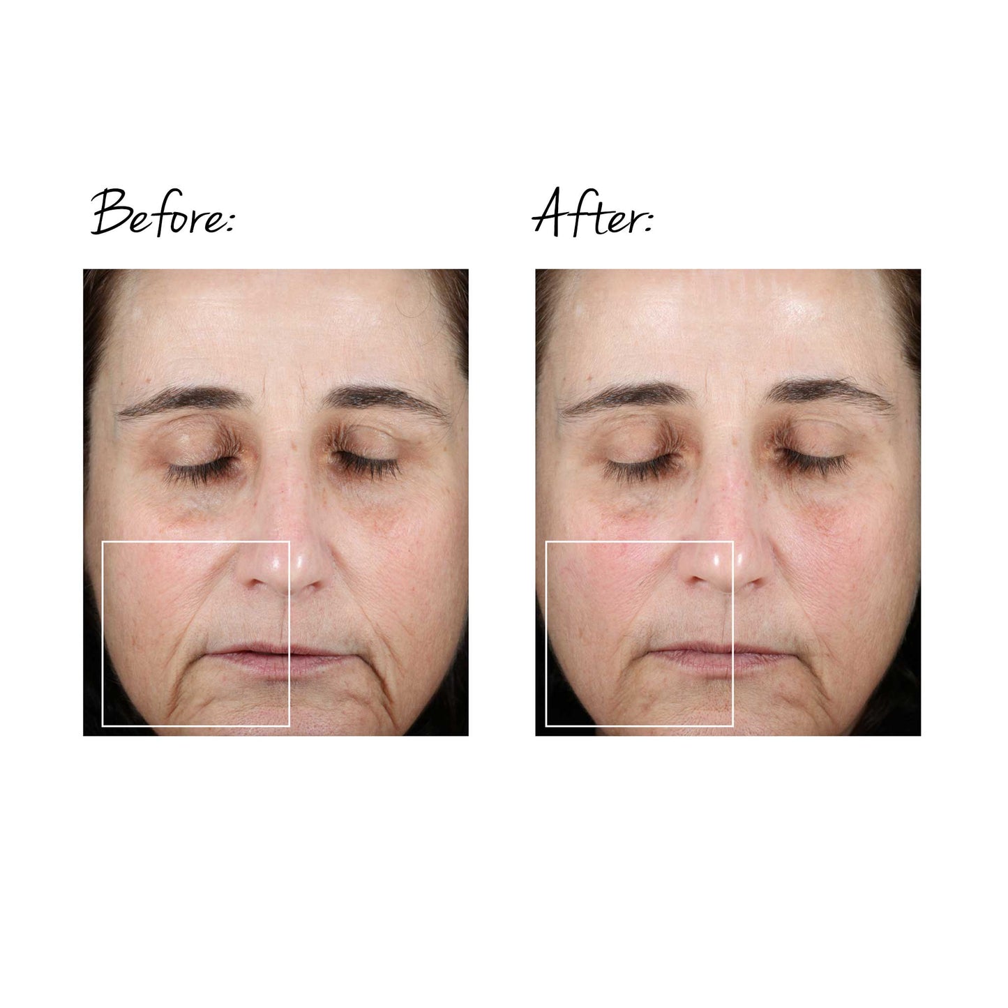 TRINITY FACIAL TONING DEVICE