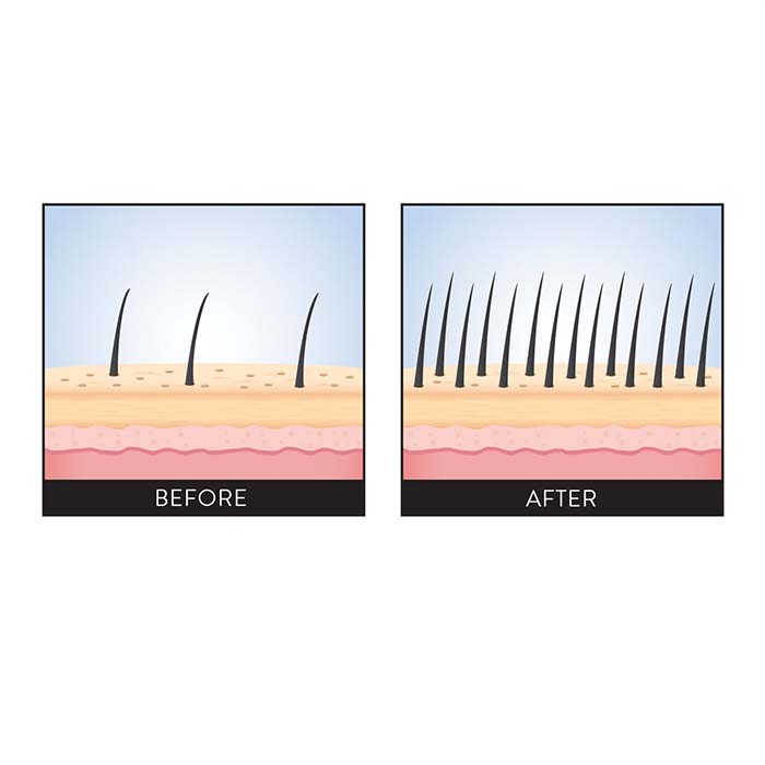SCALP BOOSTER
