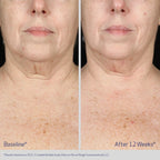 ELASTIderm Neck and Decollete Concentrate 60 mL