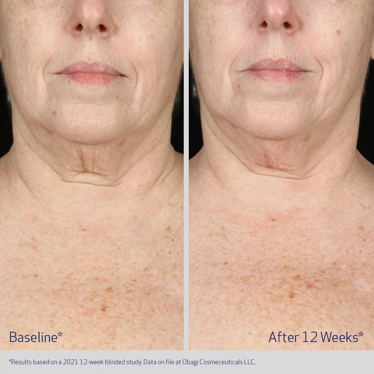 ELASTIderm Neck and Decollete Concentrate 60 mL