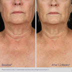 ELASTIderm Neck and Decollete Concentrate 60 mL