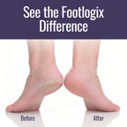 Ultimate "At Home" Foot Care Combo