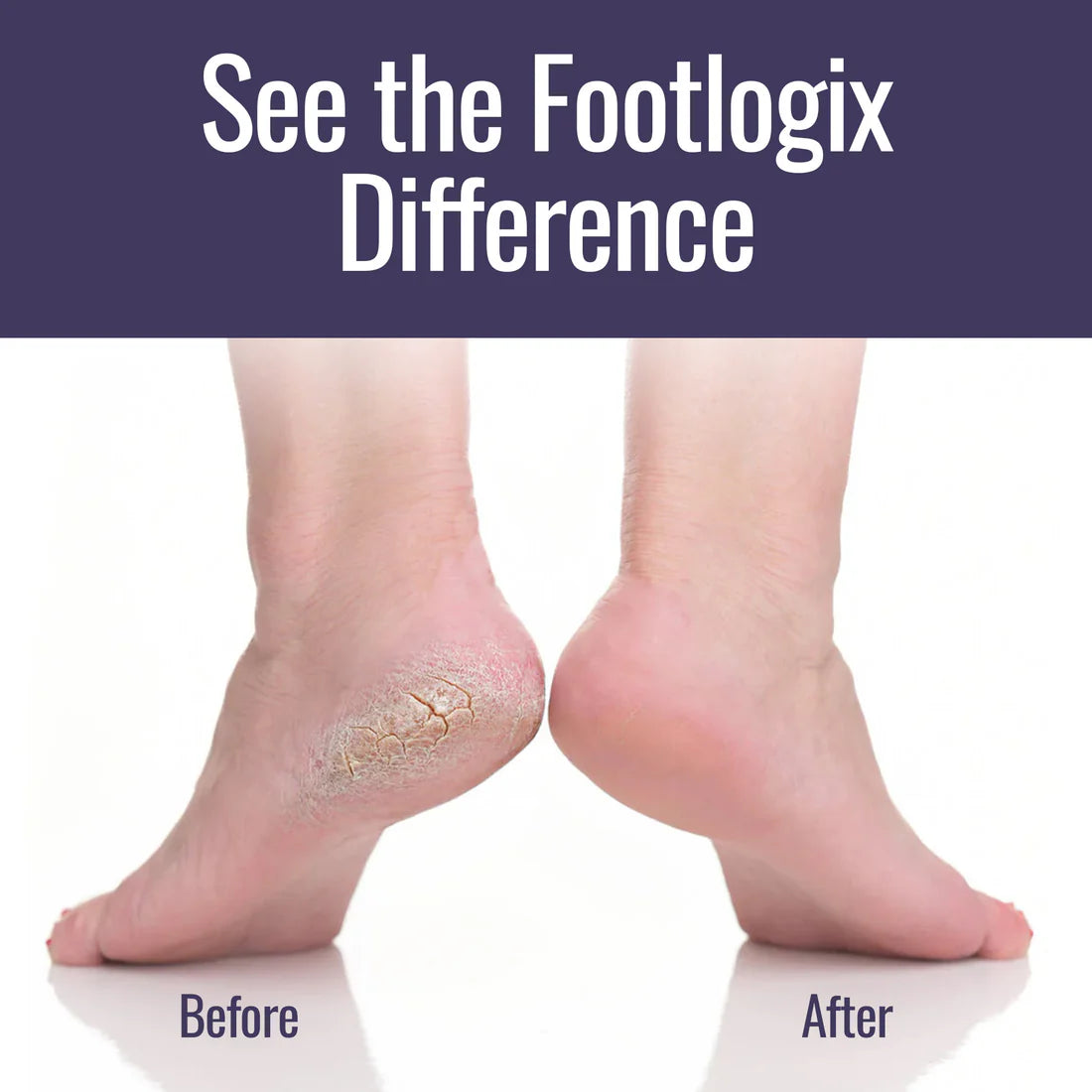 Ultimate "At Home" Foot Care Combo