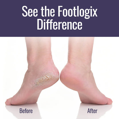 Ultimate "At Home" Foot Care Combo