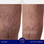 THE BODY CREAM FOR CELLULITE & STRETCH MARKS