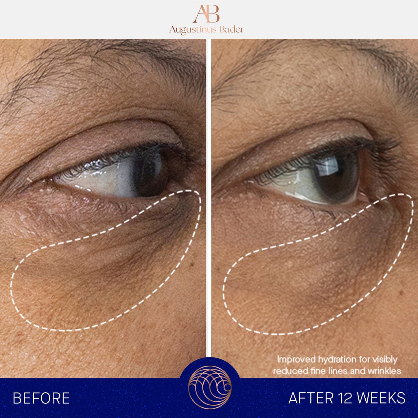 THE EYE CREAM