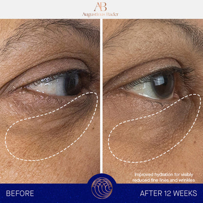THE EYE CREAM