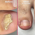 Footlogix Nail Tincture Spray 50 ml