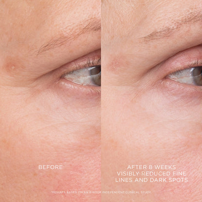 EQUILIBRIUM RESURFACING RETINOID TREATMENT
