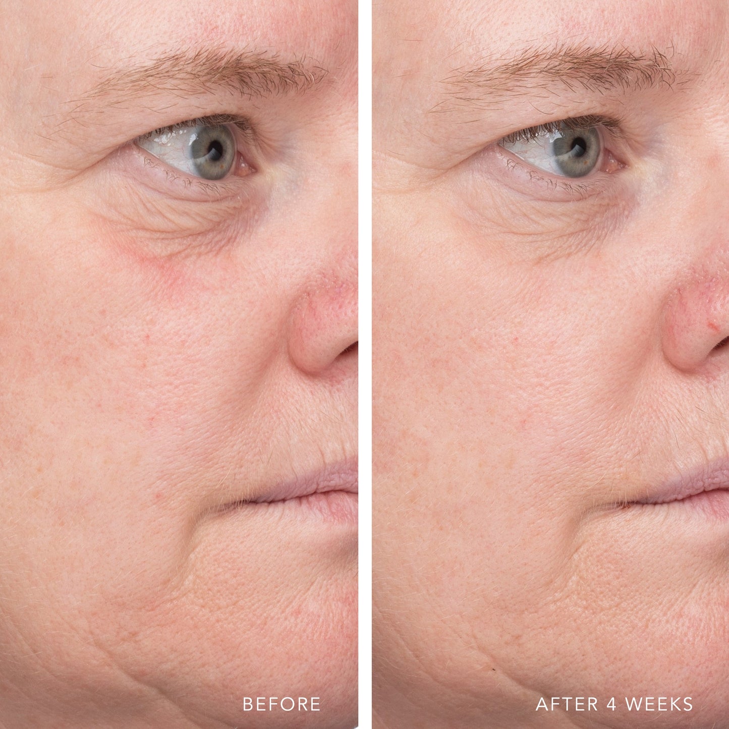 ULTRA HYDRATING SERUM WITH HYALURONIC COMPLEX-7