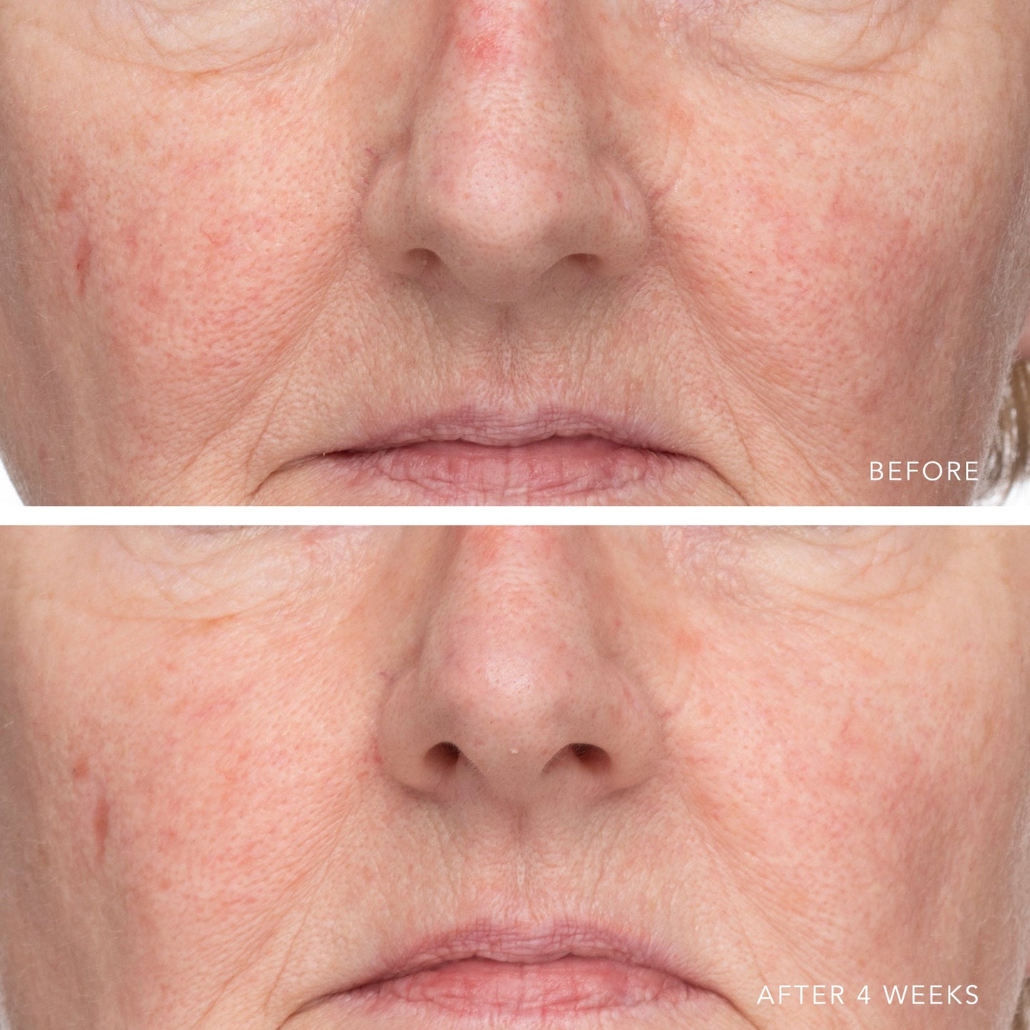 ULTRA HYDRATING SERUM WITH HYALURONIC COMPLEX-7