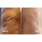 بخاخ الأكسجين من LYMA LASER & عبوة إعادة تعبئة كريم GLIDE - تكفي لمدة 30 يومًا