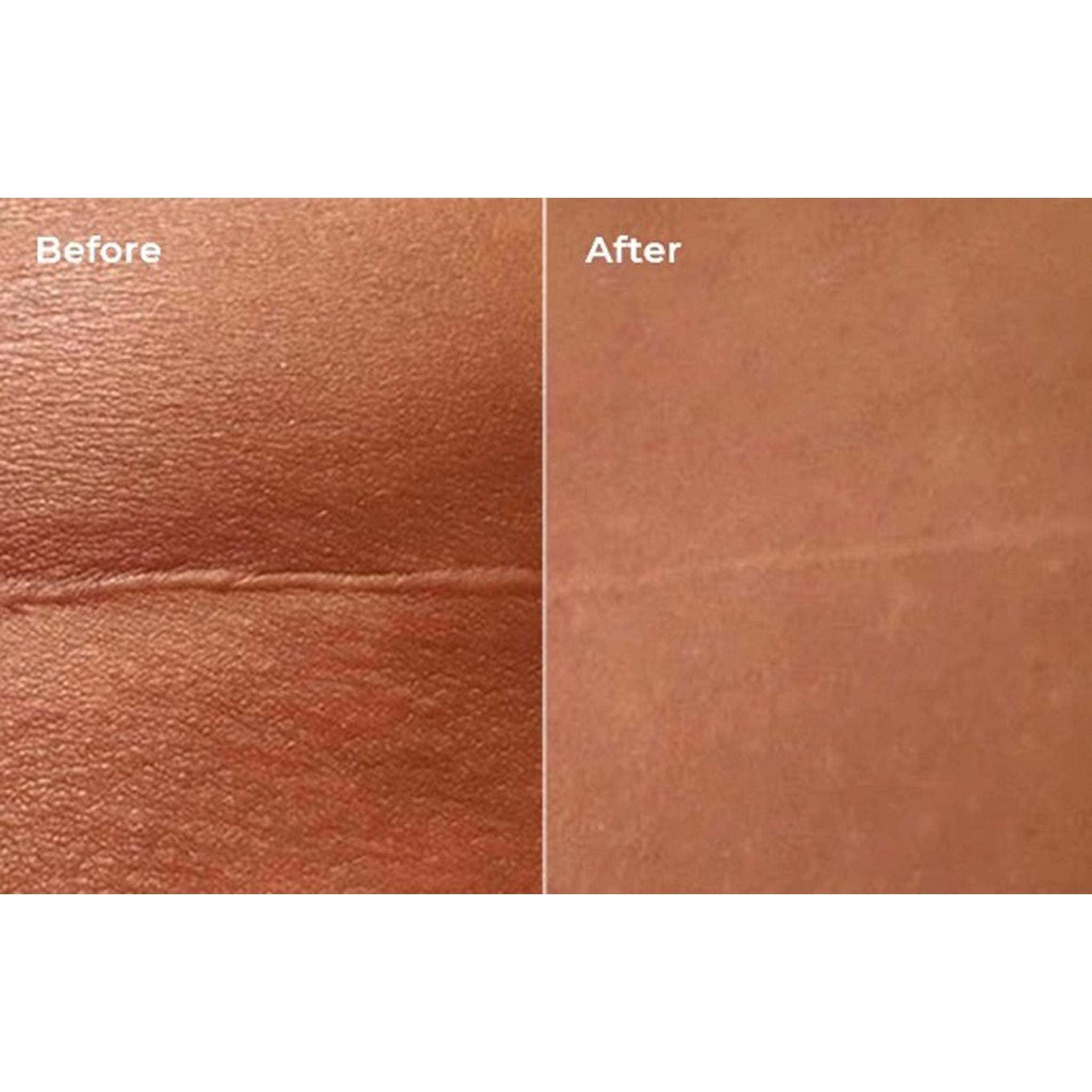 بخاخ الأكسجين من LYMA LASER & عبوة إعادة تعبئة كريم GLIDE - تكفي لمدة 30 يومًا