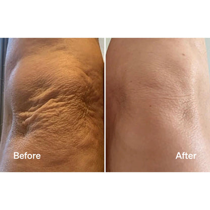 LYMA LASER OXYGEN MIST & GLIDE REFILL - 60 DAYS
