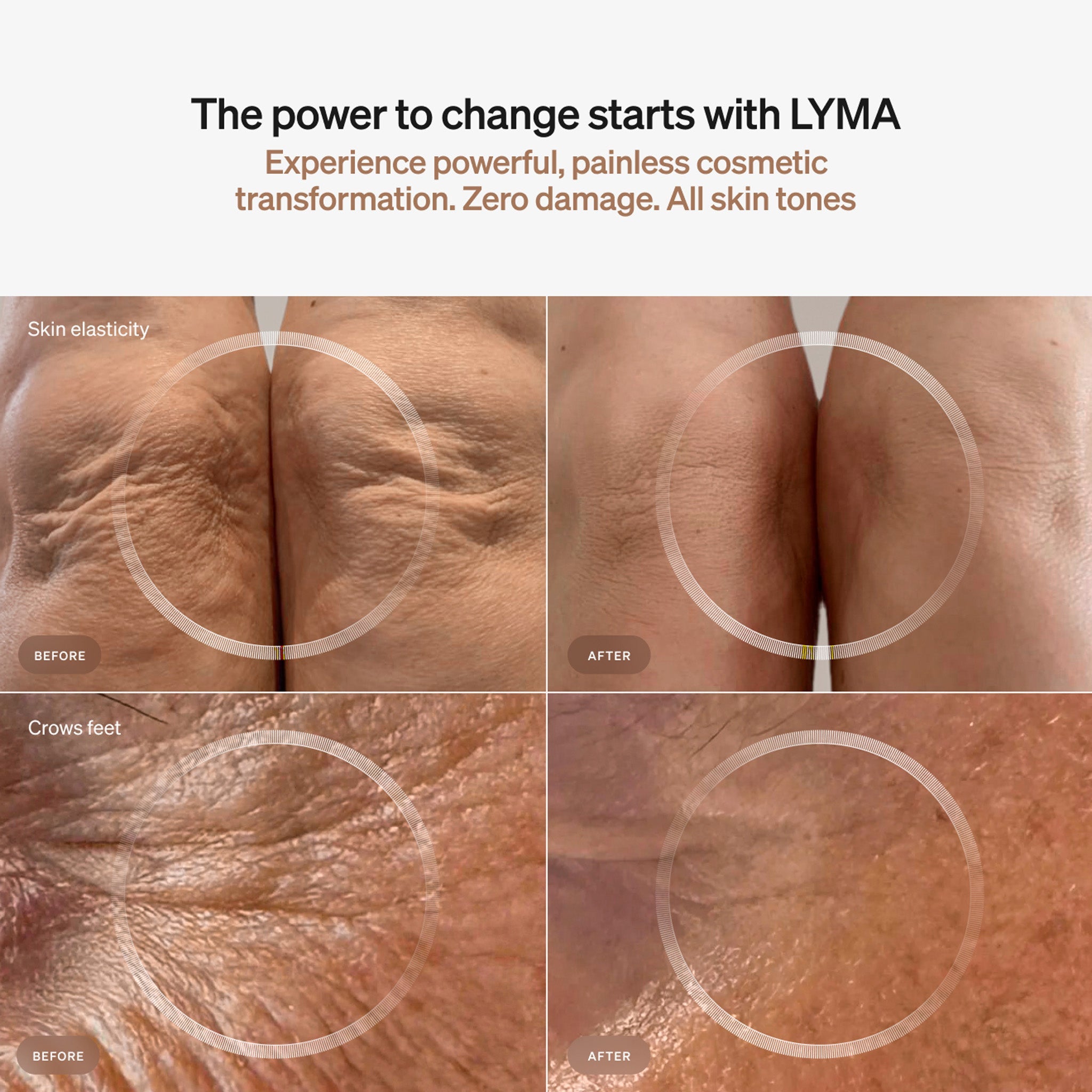 مجموعة LYMA LASER للمبتدئين