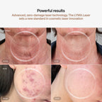 مجموعة LYMA LASER للمبتدئين