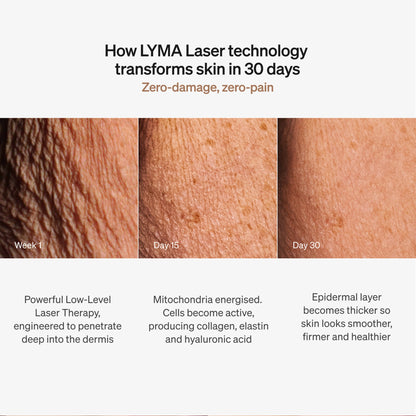 LYMA LASER STARTER KIT