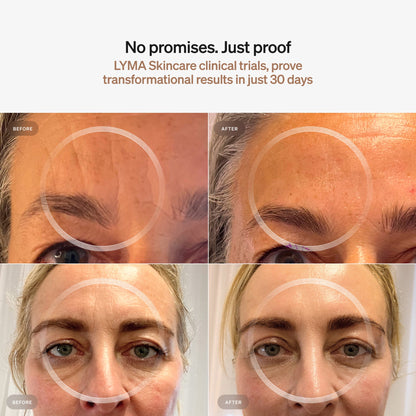 LYMA SKINCARE SERUM + CREAM STARTER KIT