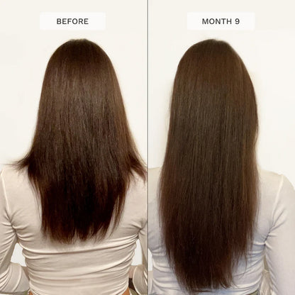 HAIRBURST FOR LONGER STRONGER HAIR SET-(SHAMPOO+CONDITIONER)