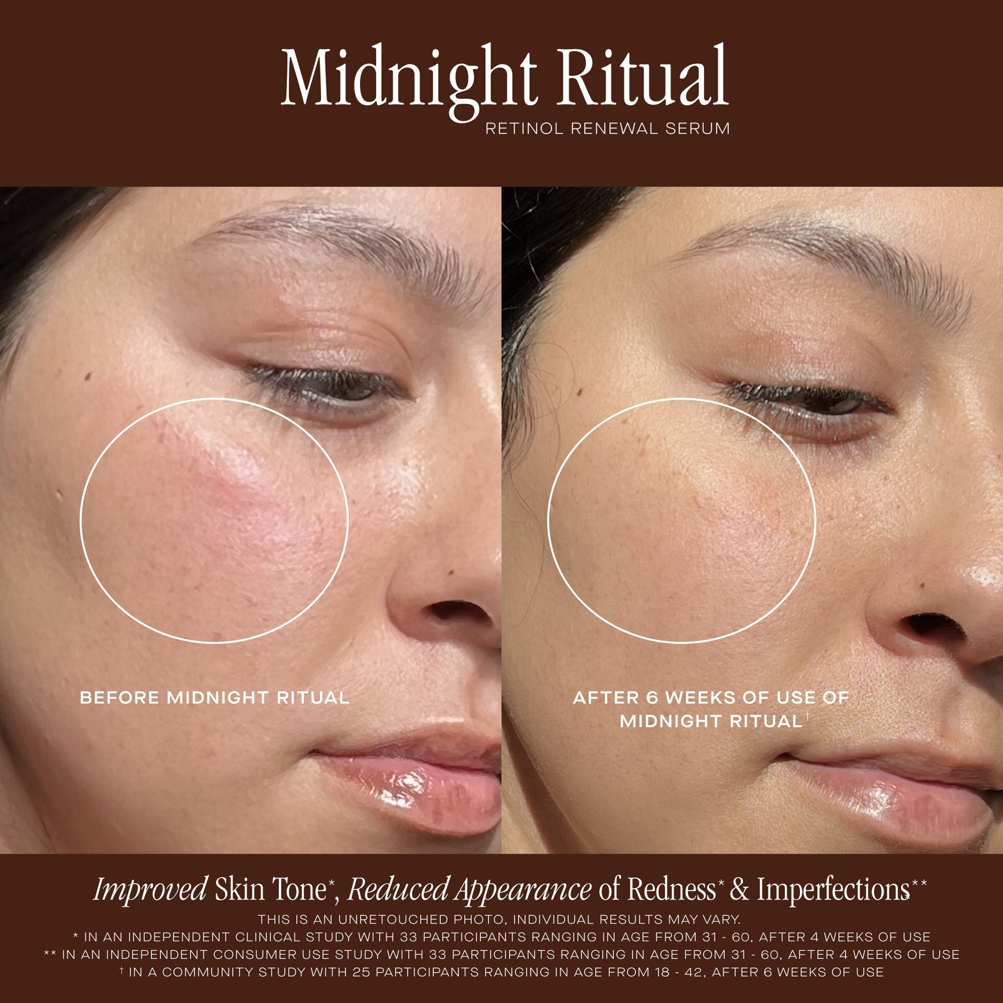 MIDNIGHT RITUAL RETINOL RENEWAL SERUM