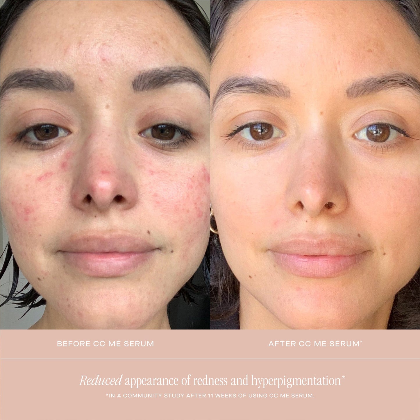 CC ME SERUM WITH VITAMIN C + NIACINAMIDE