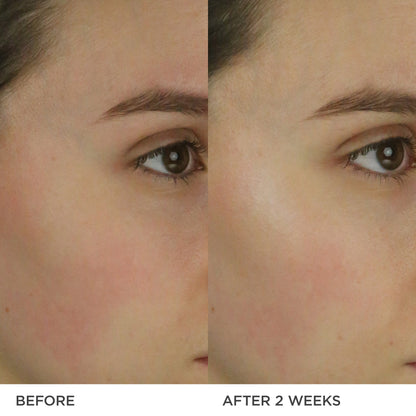 THE DEWY MILK MOISTURIZER