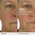 THE DEWY SKIN CREAM RICH LINE-PLUMPING MOISTURIZER