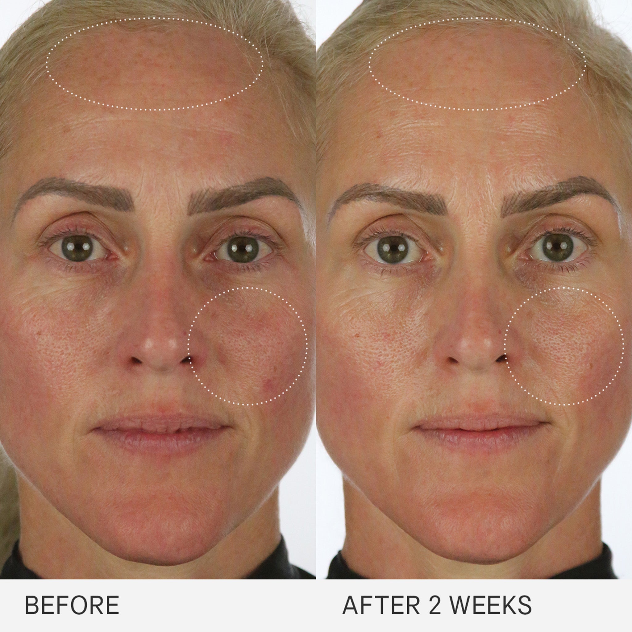 THE MILKY SUNSCREEN