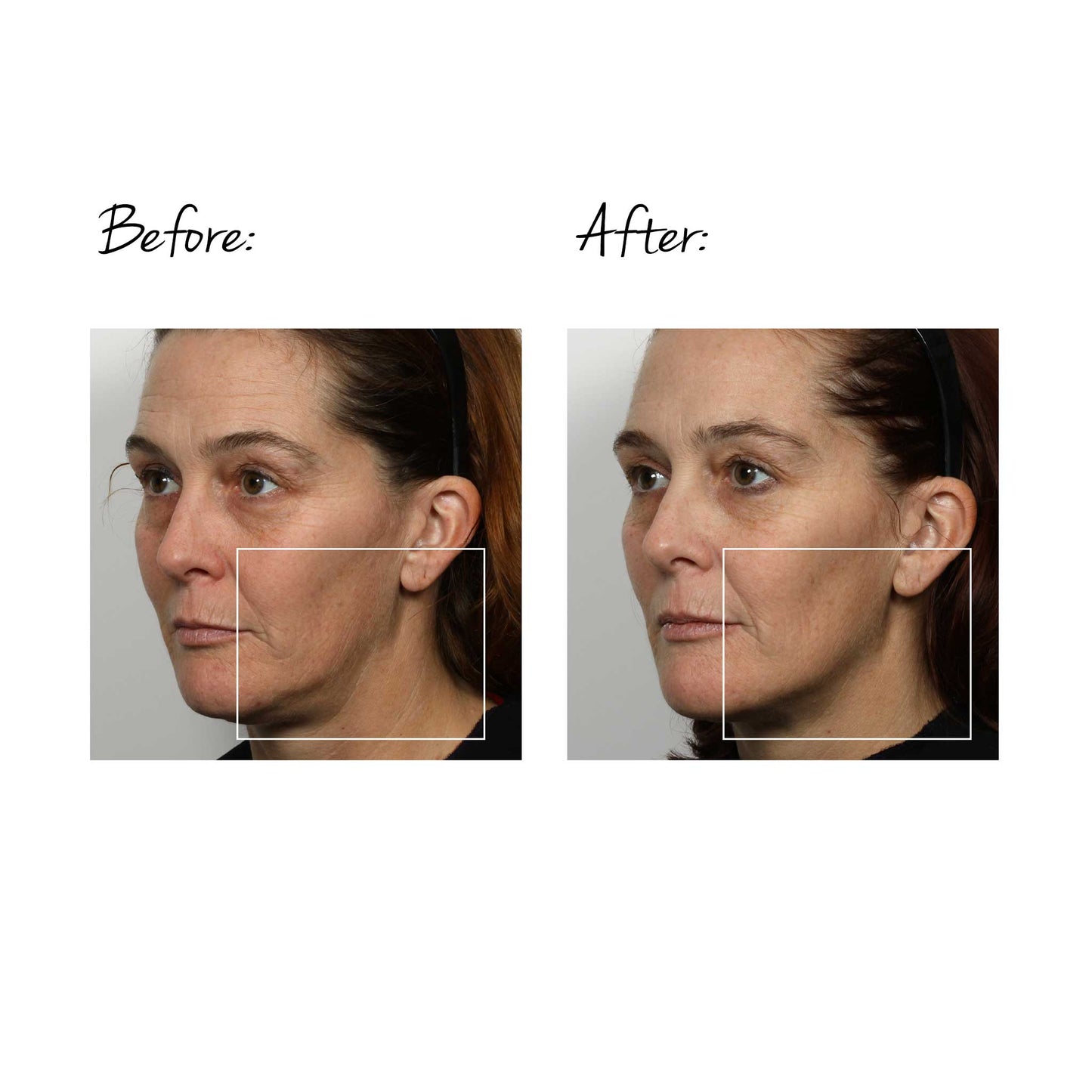 TRINITY FACIAL TONING DEVICE