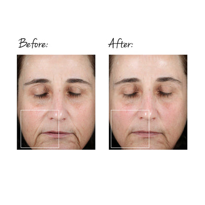 TRINITY FACIAL TONING DEVICE