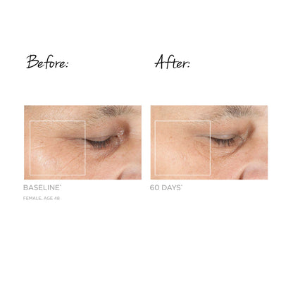 TRINITY FACIAL TONING DEVICE
