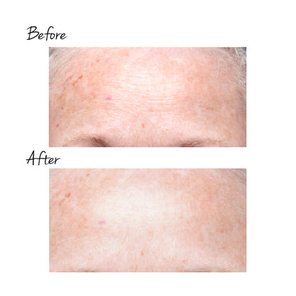 TRINITY WRINKLE REDUCER ATTACHMENT