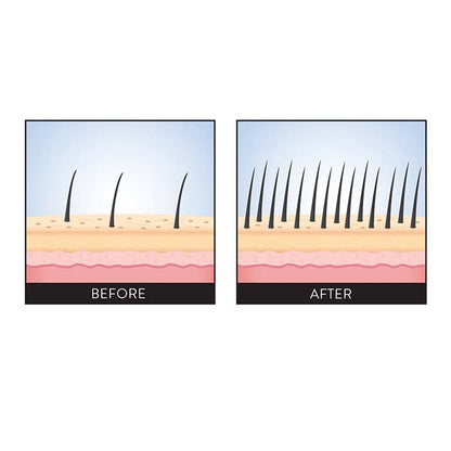 SCALP BOOSTER